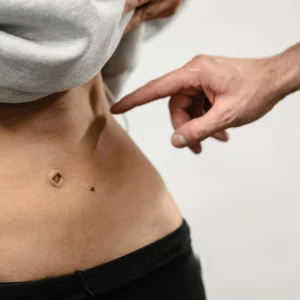 Tratamiento antifibrosis (4 sesiones de carboxiterapia y enzimas recombinantes)